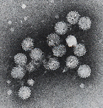 Hepatitis C